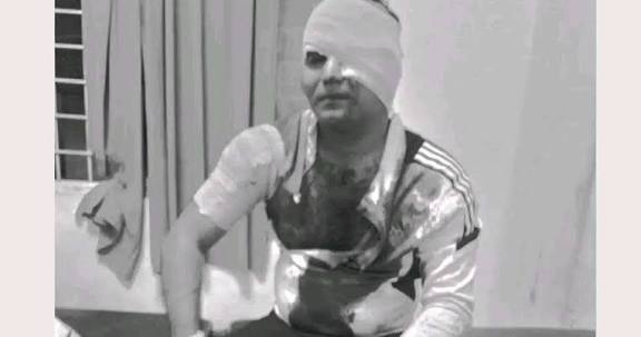 जेन जी आन्दोलनसँग संलग्न भएको आरोपमा एकजनामाथि खुकुरी प्रहार