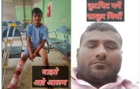 पर्सागढीमा युवकमाथि निर्घात आक्रमण, खुट्टा काटिदिँदा गम्भीर