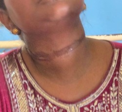 वीरगञ्जमा पुरानो जग्गा विवाद र पंखा चोरीको विषयलाई लिएर महिला माथि ज्यान मार्ने प्रयास, एक गम्भीर घाइते