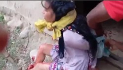 श्रीमतीमाथि श्रीमानको क्रूर आक्रमण : धारिलो हतियार प्रहारपछि खुट्टा काटियो, आरोपी फरार