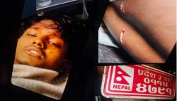 कलैयामा पूर्व वडा अध्यक्षका छोरामाथि चक्कु प्रहार, एक जना गम्भीर घाइते