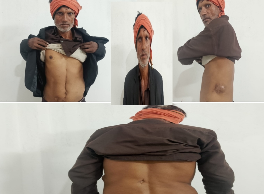 “मधेसको हकका लागि लडेँ, अब परिवार पाल्न संघर्ष गर्दैछु” :-मधेस आन्दोलनका योद्धा पटेल